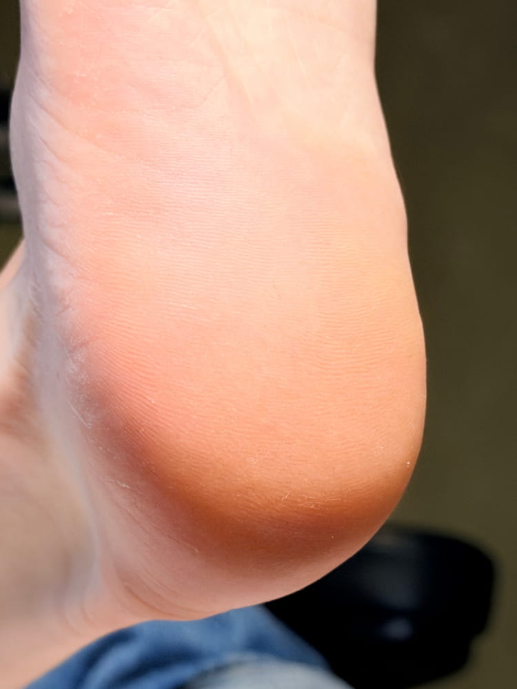 Pedicure near me Uppsala
